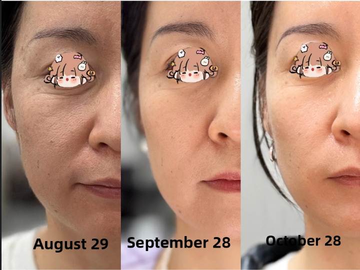 Look 10 Years Younger Within 2 Months