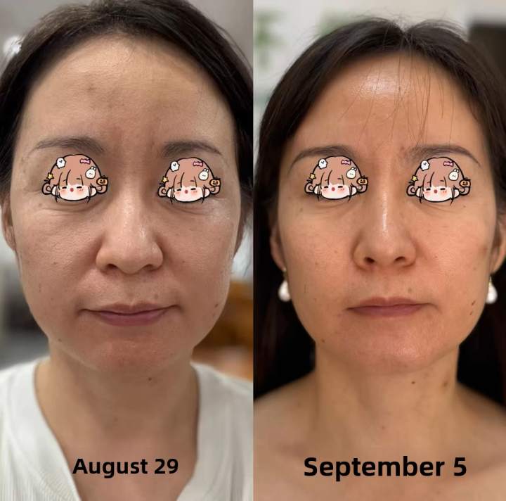 Youthful Transformation in 2 Months