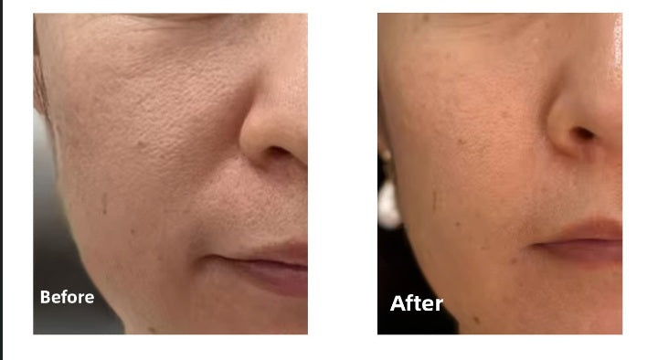 Visibly Smoothes Wrinkles